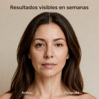 Crema Anti Ojeras  con Calcio