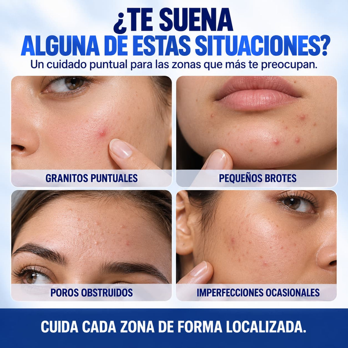 Loción Secante para Granos con Ácido Salicílico