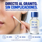 Loción Secante para Granos con Ácido Salicílico